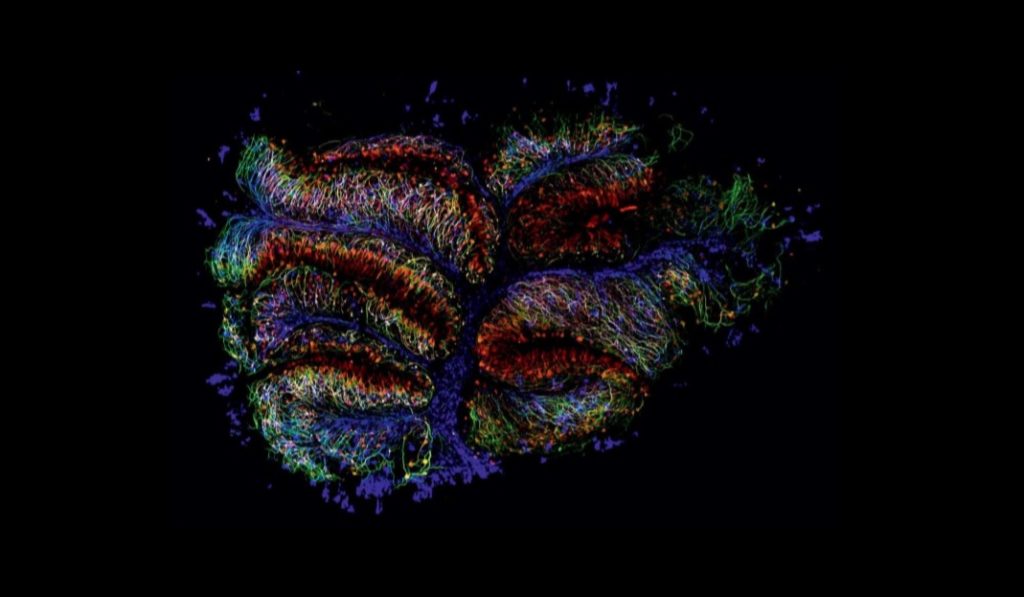 exposicion medularte