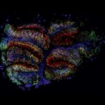 exposicion medularte