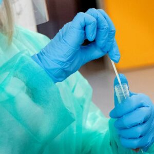 Toledo registra ya 20 casos de viruela del mono, los dos últimos esta semana