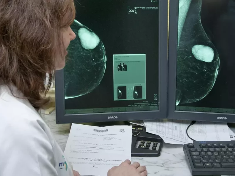 3.000 mamografías pendientes en Talavera de la Reina tras la renuncia de una empresa privada al servicio preventivo