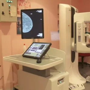 La empresa que dejó tirada a la Junta con las mamografías en Talavera no pagó a los trabajadores, según CCOO