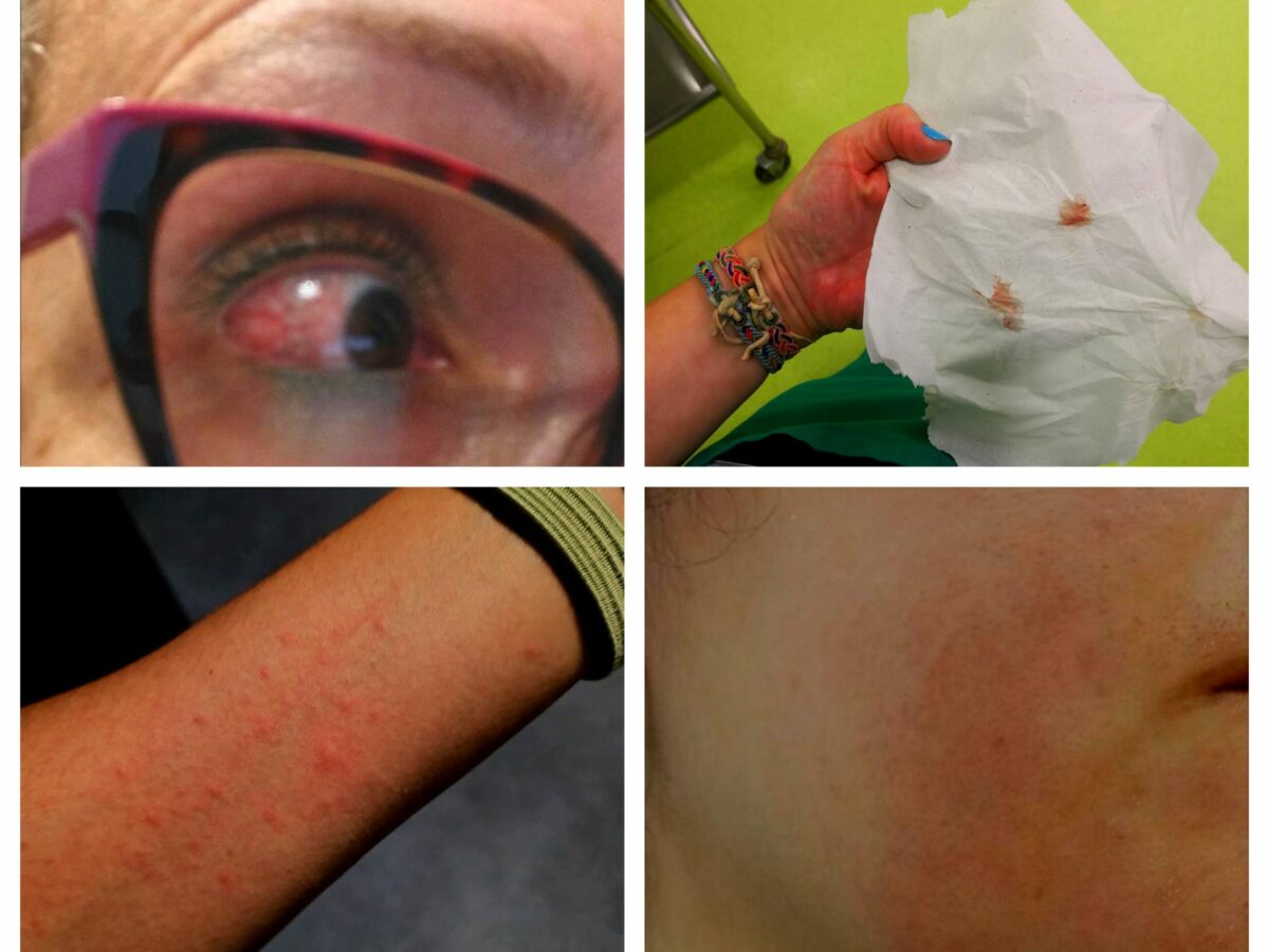 Un año de intoxicaciones en los laboratorios del Hospital de Toledo: "No sabemos qué está haciendo enfermar a los trabajadores"